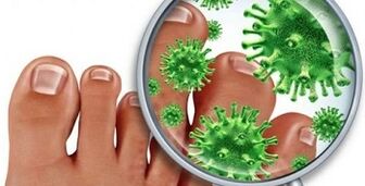 How to treat fungal infections on your fingers