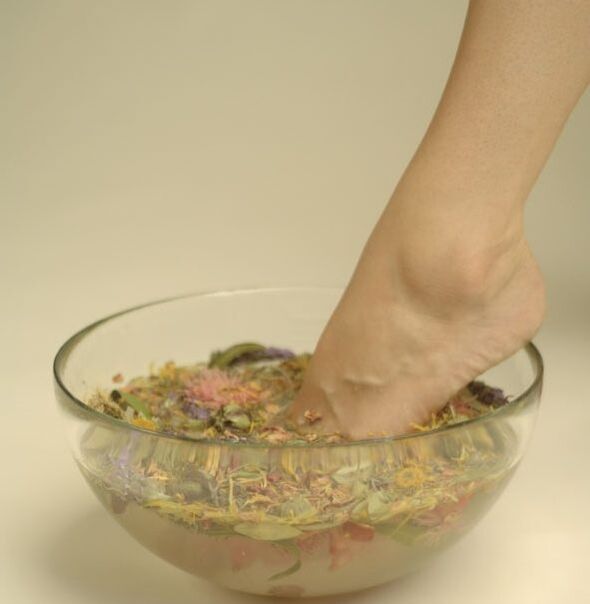 Herbal bath for onychomycosis