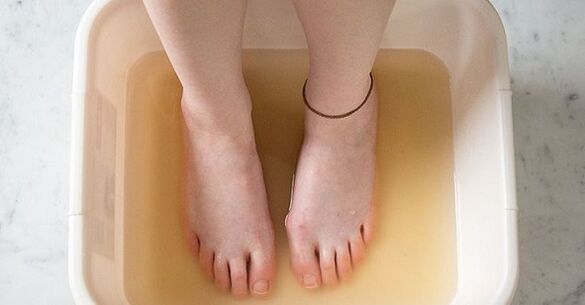 Iodine bath treatment for onychomycosis