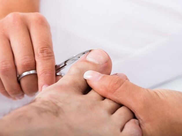 remove toenails
