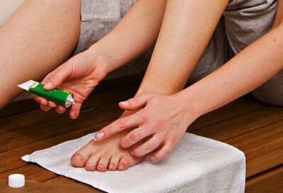 Apply ointment to treat onychomycosis