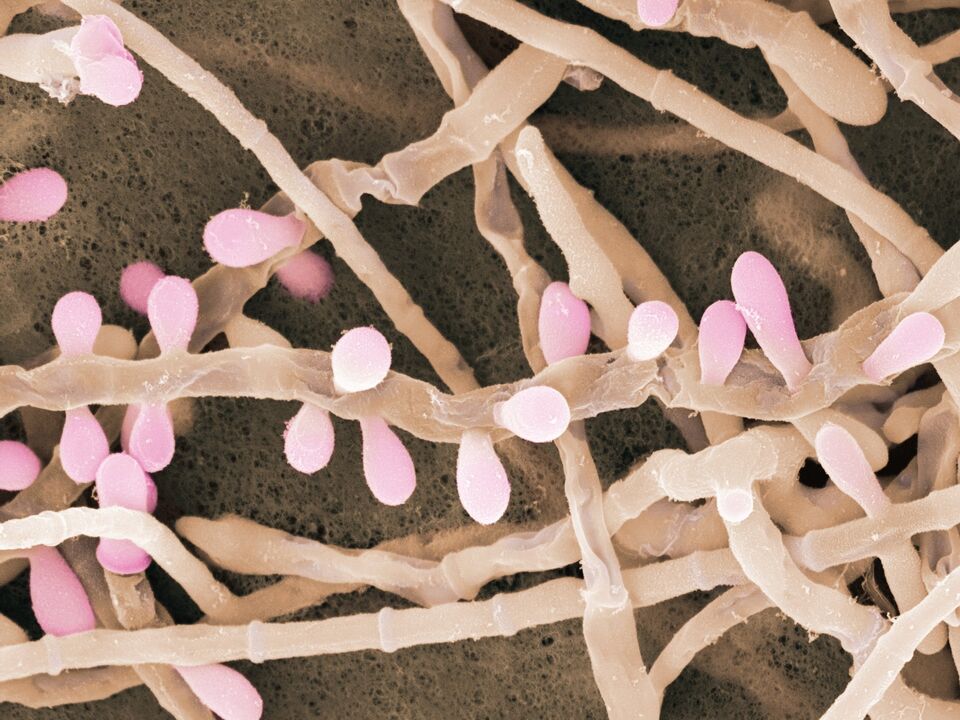 Trichophyton rubrum is a fungus that affects the skin of the feet.